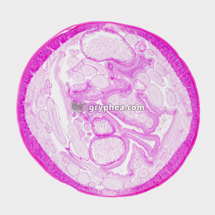 Ascaris du Cheval - ver parasite - femelle en CT x7 - gryphea.org